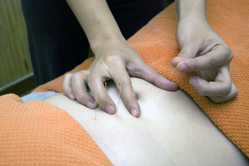 osteopathe-POURRIERES-min_acupuncture-4175625